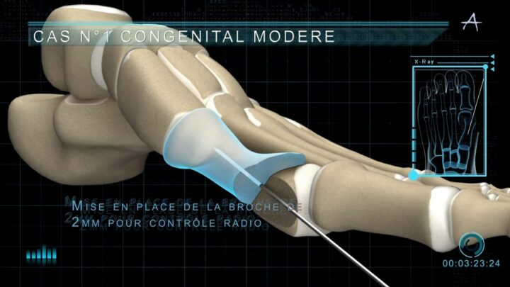 imagerie médicale 3d impression 3d médicale